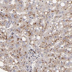 ABCB1 Rabbit anti-Human, Polyclonal, Abnova 100uL:Antibodies, Polyclonal