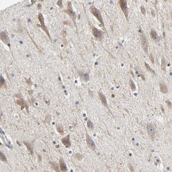 LRP1 Rabbit anti-Human, Polyclonal, Abnova 100uL:Antibodies, Polyclonal