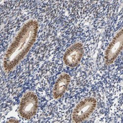 PGR Rabbit anti-Human, Polyclonal, Abnova 100 &mu;L | Buy Online | Abnova | Fisher Scientific