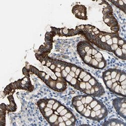 FLNB Rabbit anti-Human, Polyclonal, Abnova 100uL:Antibodies, Polyclonal