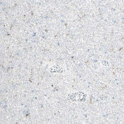 NRG1 Rabbit anti-Human, Polyclonal, Abnova 100 &mu;L | Buy Online | Abnova | Fisher Scientific