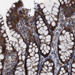 ATP7B Rabbit anti-Human, Polyclonal, Abnova 100uL:Antibodies, Polyclonal