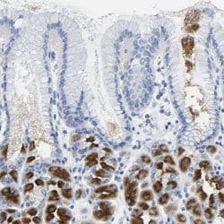 GPR15 Rabbit anti-Human, Polyclonal, Abnova 100 &mu;L | Buy Online | Abnova | Fisher Scientific