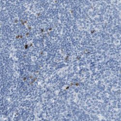 GPR18 Rabbit anti-Human, Polyclonal, Abnova 100uL:Antibodies, Polyclonal