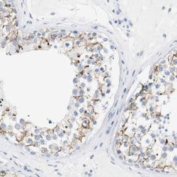 OPRM1 Rabbit anti-Human, Polyclonal, Abnova 100uL:Antibodies, Polyclonal