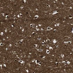 GAP43 Rabbit anti-Human, Polyclonal, Abnova 100 &mu;L | Buy Online | Abnova | Fisher Scientific