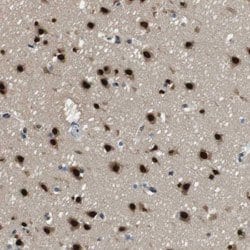 NEK4 Rabbit anti-Human, Polyclonal, Abnova 100uL:Antibodies, Polyclonal