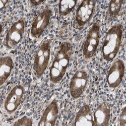 OTUD5 Rabbit anti-Human, Polyclonal, Abnova 100uL:Antibodies, Polyclonal