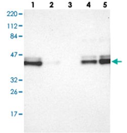NFKBIE Rabbit anti-Human, Polyclonal, Abnova 100 &mu;L | Buy Online | Abnova | Fisher Scientific