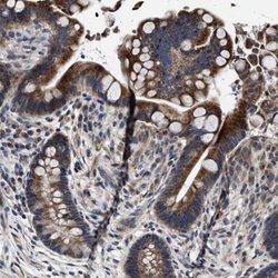 TRAF6 Rabbit anti-Human, Mouse, Rat, Polyclonal, Abnova 100uL:Antibodies,
