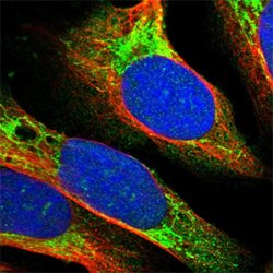 TRAF6 Rabbit anti-Human, Mouse, Rat, Polyclonal, Abnova 100uL:Antibodies,