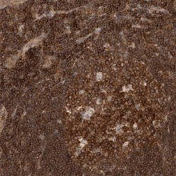 NFKB1 Rabbit anti-Human, Polyclonal, Abnova 100uL:Antibodies, Polyclonal
