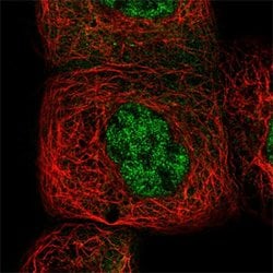 NFKB1 Rabbit anti-Human, Polyclonal, Abnova 100uL:Antibodies, Polyclonal