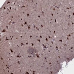 RELB Rabbit anti-Human, Polyclonal, Abnova 100uL:Antibodies, Polyclonal