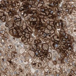 ALPL Rabbit anti-Human, Polyclonal, Abnova 100uL:Antibodies, Polyclonal