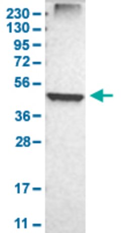 FDFT1 Rabbit anti-Human, Mouse, Rat, Polyclonal, Abnova 100uL:Antibodies,
