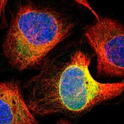 FDFT1 Rabbit anti-Human, Mouse, Rat, Polyclonal, Abnova 100uL:Antibodies,