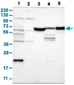JPH1 Rabbit anti-Human, Polyclonal, Abnova 100uL:Antibodies, Polyclonal