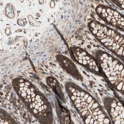 YWHAB Rabbit anti-Human, Mouse, Rat, Polyclonal, Abnova 100uL:Antibodies,