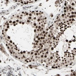 SENP1 Rabbit anti-Human, Mouse, Rat, Polyclonal, Abnova 100uL:Antibodies,