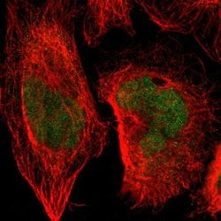 SENP1 Rabbit anti-Human, Mouse, Rat, Polyclonal, Abnova 100uL:Antibodies,