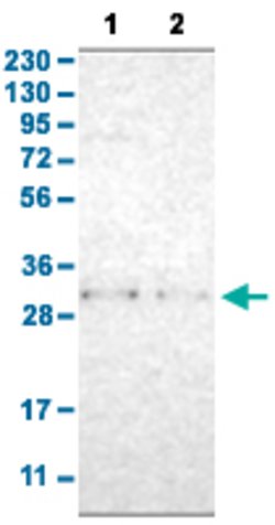 TNFAIP1 Rabbit anti-Human, Polyclonal, Abnova 100uL:Antibodies, Polyclonal