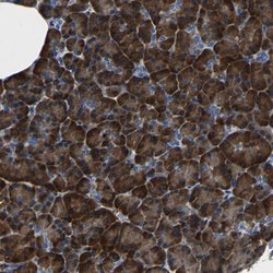 TNFAIP1 Rabbit anti-Human, Polyclonal, Abnova 100uL:Antibodies, Polyclonal