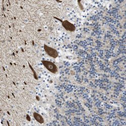 BRD4 Rabbit anti-Human, Polyclonal, Abnova 100uL:Antibodies, Polyclonal