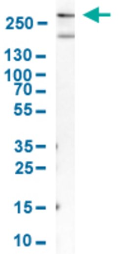 MYH11 Rabbit anti-Human, Polyclonal, Abnova 100uL:Antibodies, Polyclonal