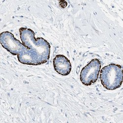 MYH11 Rabbit anti-Human, Polyclonal, Abnova 100uL:Antibodies, Polyclonal