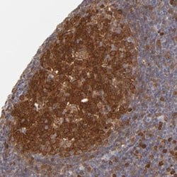 PRKCD Rabbit anti-Human, Polyclonal, Abnova 100uL:Antibodies, Polyclonal