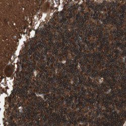 ATP6AP2 Rabbit anti-Human, Mouse, Rat, Polyclonal, Abnova 100 &mu;L | Buy Online | Abnova Corporation | Fisher Scientific