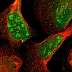 ATP6AP2 Rabbit anti-Human, Mouse, Rat, Polyclonal, Abnova 100 &mu;L | Buy Online | Abnova Corporation | Fisher Scientific