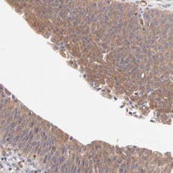 ASB7 Rabbit anti-Human, Polyclonal, Abnova 100uL:Antibodies, Polyclonal