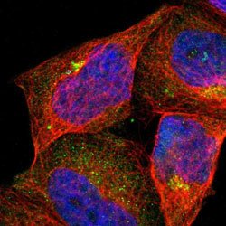 ASB7 Rabbit anti-Human, Polyclonal, Abnova 100uL:Antibodies, Polyclonal
