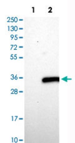 ASB7 Rabbit anti-Human, Polyclonal, Abnova 100uL:Antibodies, Polyclonal