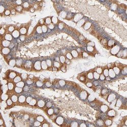STRN3 Rabbit anti-Human, Polyclonal, Abnova 100uL:Antibodies, Polyclonal
