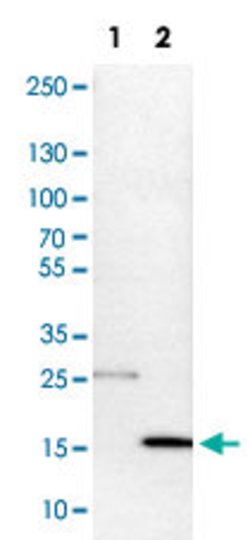 DNAL4 Rabbit anti-Human, Rat, Polyclonal, Abnova 100 &mu;L | Buy Online | Abnova Corporation | Fisher Scientific