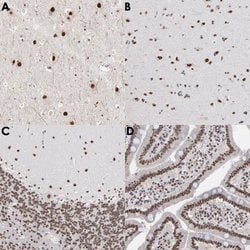 ZNF3 Rabbit anti-Human, Mouse, Polyclonal, Abnova 100uL:Anticuerpos