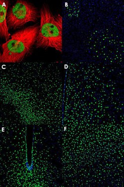 ZNF3 Rabbit anti-Human, Mouse, Polyclonal, Abnova 100uL:Anticuerpos