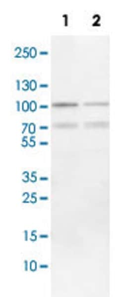 FOXP1 Rabbit anti-Human, Mouse, Rat, Polyclonal, Abnova 100uL:Antibodies,