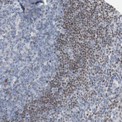 FOXP1 Rabbit anti-Human, Mouse, Rat, Polyclonal, Abnova 100uL:Antibodies,