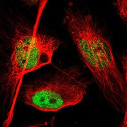 FOXP1 Rabbit anti-Human, Mouse, Rat, Polyclonal, Abnova 100uL:Antibodies,