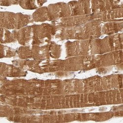 MAPK3 Rabbit anti-Human, Polyclonal, Abnova 100uL:Antibodies, Polyclonal