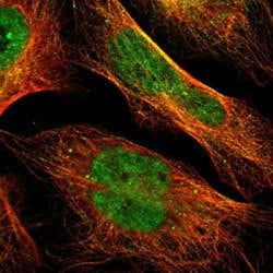 MAPK3 Rabbit anti-Human, Polyclonal, Abnova 100uL:Antibodies, Polyclonal