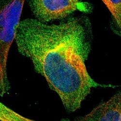 AHNAK2 Rabbit anti-Human, Polyclonal, Abnova 100uL:Antibodies, Polyclonal