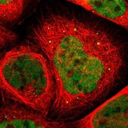 RUNX1 Rabbit anti-Human, Polyclonal, Abnova 100uL:Antibodies, Polyclonal