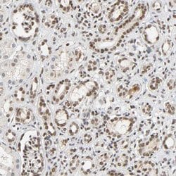 NCOA6 Rabbit anti-Human, Polyclonal, Abnova 100uL:Antibodies, Polyclonal