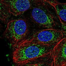 NDUFS3 Rabbit anti-Human, Polyclonal, Abnova 100 &mu;L | Buy Online | Abnova Corporation | Fisher Scientific