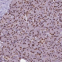 AKAP8 Rabbit anti-Human, Polyclonal, Abnova 100uL:Antibodies, Polyclonal